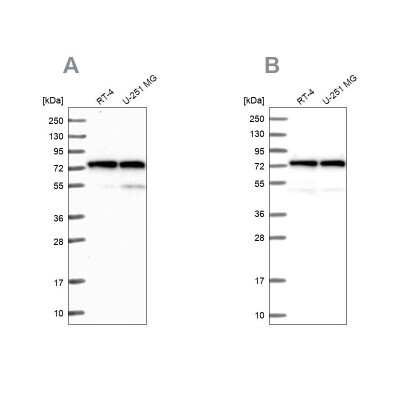 Western Blot: Lysyl tRNA synthetase Antibody [NBP1-87705]