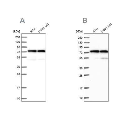 Western Blot: Lysyl tRNA synthetase Antibody [NBP1-87706]
