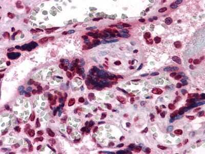 Immunohistochemistry-Paraffin: M-CSF Antibody (2D10) - BSA Free [NBP1-47472]
