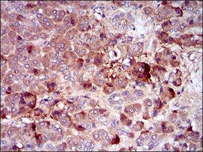 Immunohistochemistry-Paraffin: M-CSFR/CD115 Antibody (6B9B9) - BSA Free [NBP2-37292]