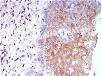 Immunohistochemistry-Paraffin: M-CSFR/CD115 Antibody (6B9B9) - BSA Free [NBP2-37292]