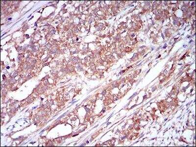 Immunohistochemistry-Paraffin: M-CSFR/CD115 Antibody (6B9H2) - BSA Free [NBP2-37289]