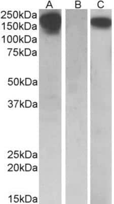 Western Blot: M-CSFR/CD115 Antibody [NBP1-52070]