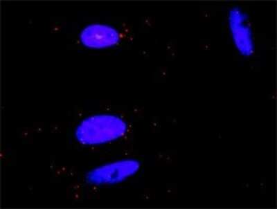Proximity Ligation Assay: M-CSFR/CD115 Antibody (1G4) [H00001436-M01]
