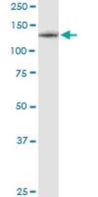 Western Blot: M-CSFR/CD115 Antibody (1G4) [H00001436-M01]