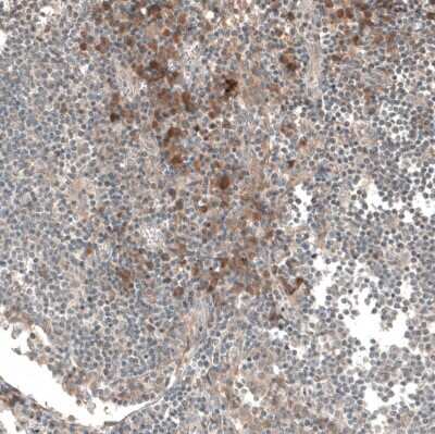 Immunohistochemistry-Paraffin: M-CSFR/CD115 Antibody [NBP1-84532]
