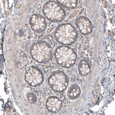 Immunohistochemistry-Paraffin: M-CSFR/CD115 Antibody [NBP1-84532]