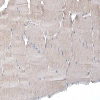 Immunohistochemistry-Paraffin: M-CSFR/CD115 Antibody [NBP1-84532]