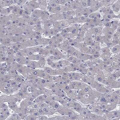 Immunohistochemistry-Paraffin: MAATS1 Antibody [NBP3-17106]