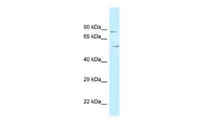 Western Blot: MAATS1 Antibody [NBP2-86593]