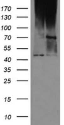 Western Blot: MAB21L3 Antibody (OTI2A3) [NBP2-46598]