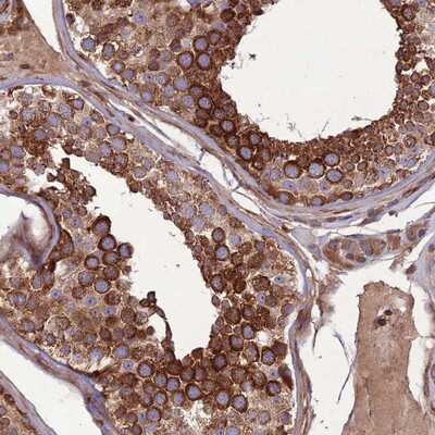 Immunohistochemistry-Paraffin: MAB21L3 Antibody [NBP1-94119]