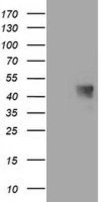Western Blot: MAB21L3 Antibody (OTI1F6) [NBP2-00611]