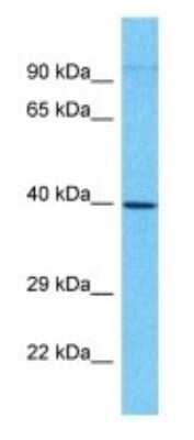 Western Blot: MAB21L3 Antibody [NBP3-09750]