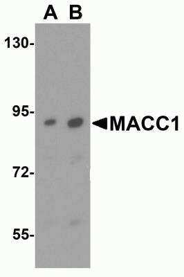 Western Blot: MACC1 AntibodyBSA Free [NBP2-82006]