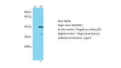 Western Blot: MACROD1 Antibody [NBP2-85248]