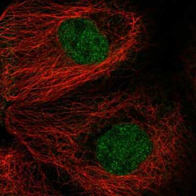 Immunocytochemistry/ Immunofluorescence: MAD2L1 Antibody [NBP1-83185]