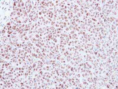 Immunohistochemistry-Paraffin: MAD2L1 Antibody [NBP1-31311]