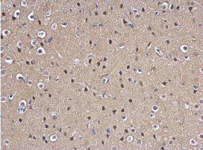 Immunohistochemistry-Paraffin: MAD2L1 Antibody [NBP1-31311]