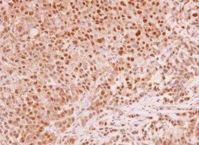 Immunohistochemistry-Paraffin: MAD2L1 Antibody [NBP1-31311]