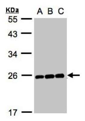 Western Blot: MAD2L1 Antibody [NBP1-31311]