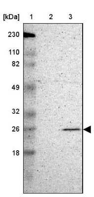 Western Blot: MAD2L1 Antibody [NBP1-83185]