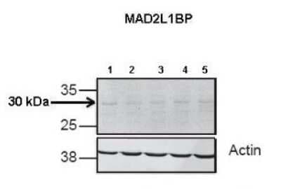 Western Blot: MAD2L1-binding protein Antibody [NBP1-79887]
