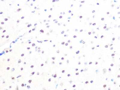 Immunohistochemistry-Paraffin: MAD2L2 Antibody (7B6I2) [NBP3-16451]