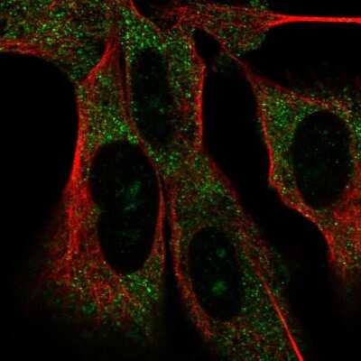 Immunocytochemistry/ Immunofluorescence: MAD2L2 Antibody [NBP2-58605]
