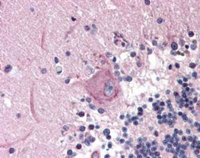 Immunohistochemistry-Paraffin: MAD2L2 Antibody - BSA Free [NBP1-02798]