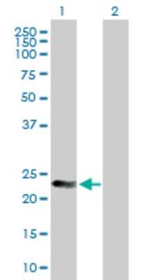 Western Blot: MAD2L2 Antibody [H00010459-B02P]