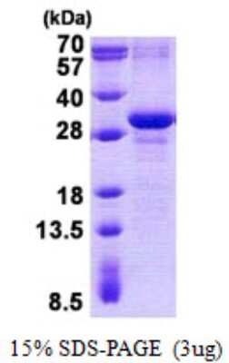 SDS-PAGE: Recombinant Human MAD3 His Protein [NBP2-23219]