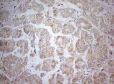 Immunohistochemistry: MAD4 Antibody (OTI7F7) - Azide and BSA Free [NBP2-72567]