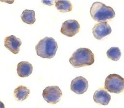 Immunocytochemistry/ Immunofluorescence: MADD Antibody - BSA Free [NBP1-77033]