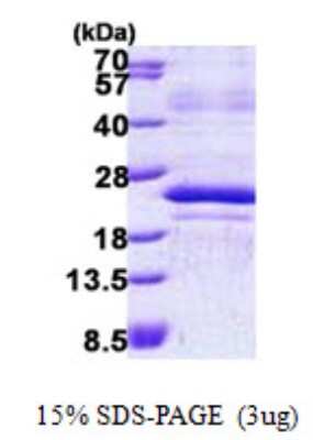 SDS-PAGE: Recombinant Human MafF His Protein [NBP2-22941]