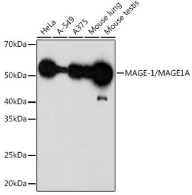 Western Blot: MAGEA1 Antibody (9Y6K1) [NBP3-15301]