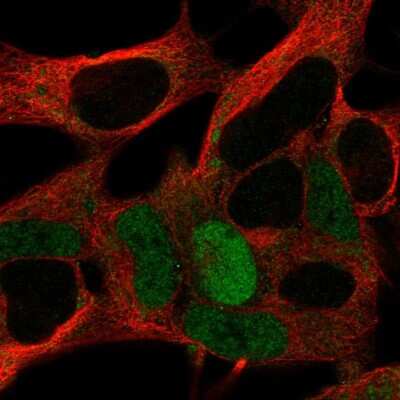 Immunocytochemistry/ Immunofluorescence: MAGEA10 Antibody [NBP2-57820]