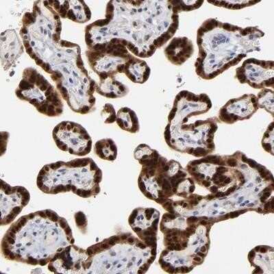 Immunohistochemistry-Paraffin: MAGEA10 Antibody [NBP1-92095]