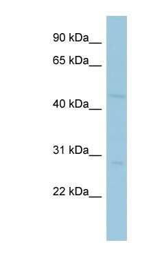 Western Blot: MAGEA10 Antibody [NBP1-57673]