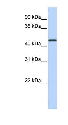 Western Blot: MAGEA10 Antibody [NBP1-57674]