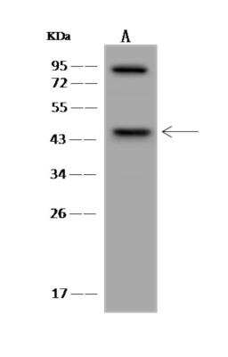 Western Blot: MAGEA10 Antibody [NBP3-06272]