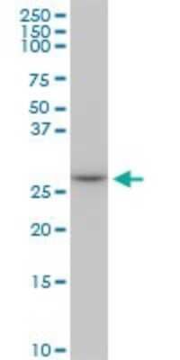 Western Blot: MAGEA12 Antibody (3A10) [H00004111-M01]