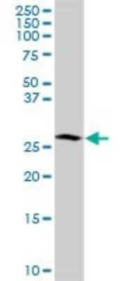 Western Blot: MAGEA12 Antibody (3A10) [H00004111-M01]