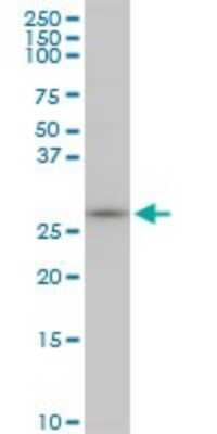 Western Blot: MAGEA12 Antibody (3A10) [H00004111-M01]