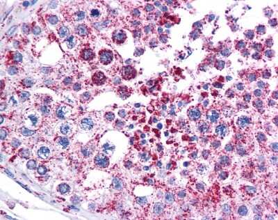 Immunohistochemistry-Paraffin: MAGEA3 Antibody [NBP1-56404]