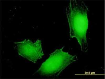 Immunocytochemistry/ Immunofluorescence: MAGEA4 Antibody (3D12) [H00004103-M01]