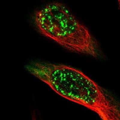 Immunocytochemistry/ Immunofluorescence: MAGEA4 Antibody [NBP1-84365]