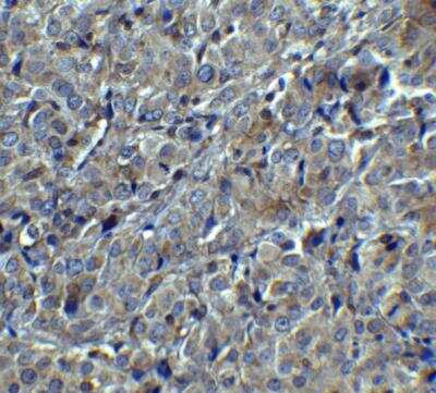 Immunohistochemistry-Paraffin: MAGEA4 Antibody - BSA Free [NBP2-41318]