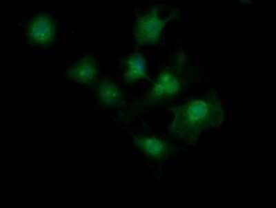 Immunofluorescence: MAGEA4 Antibody (OTI2C1) [NBP2-45720]