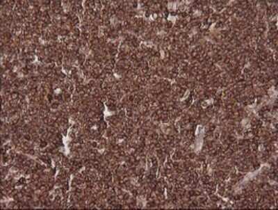 Immunohistochemistry: MAGEA4 Antibody (OTI2C1) [NBP2-45720]